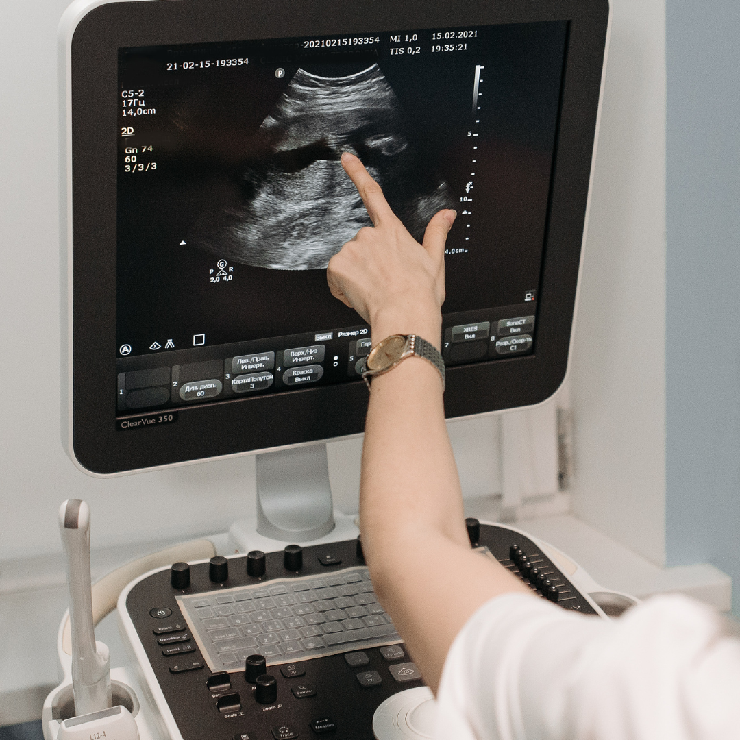 Client Review Testimonial Instagram Post (3) Diagnostic Ultrasound Cirencester